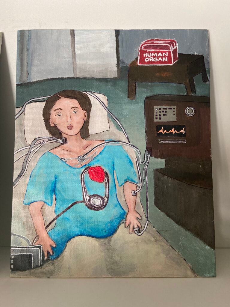Painting of a woman lying in a hospital bed, with her body connected to a life sustaining machine. On top of the machine, there is a box that says "huma organ". That organ seems to be the woman's heart, which is visible on top of her blue hospital gown. Her heart, in particular, is plugged to a machine