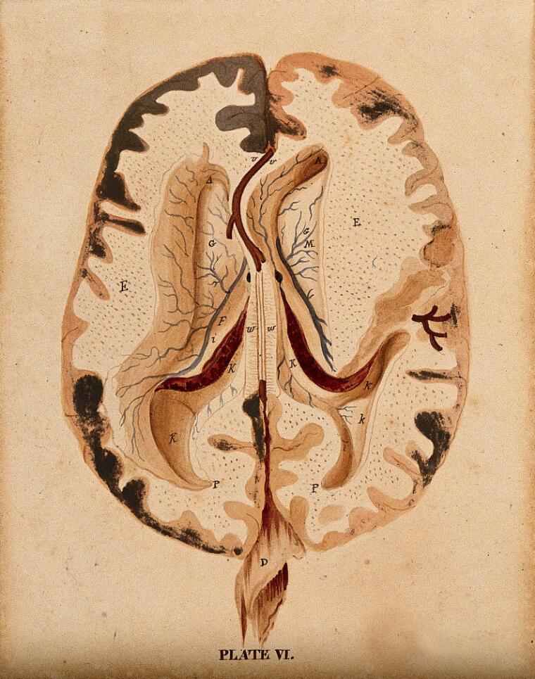 Watercolour of brain horizontal section showing lateral ventricles