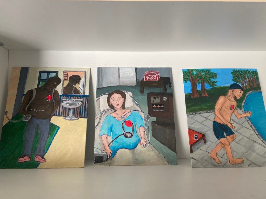 There are three paintings: displayed: first: a man standing in what appears to be a bathroom. Behind him, there is a mirror, showing half his face, and a sink. The man is shirtless, and his heart is visible on top of his skin, as it is connected to a life saving device, connected, likewise, to the wall. Second: a woman lying in a hospital bed, with her body connected to a life sustaining machine. On top of the machine, there is a box that says "huma organ". That organ seems to be the woman's heart, which is visible on top of her blue hospital gown. Her heart, in particular, is plugged to a machine. Third: a man wearing a swimsuit and swim cap, standing next to a pool. Behind him, there are trees and a blue sky. His heart is visible on top of his skin, it is connected to a very small wire that surrounds it, maybe a pacemaker.