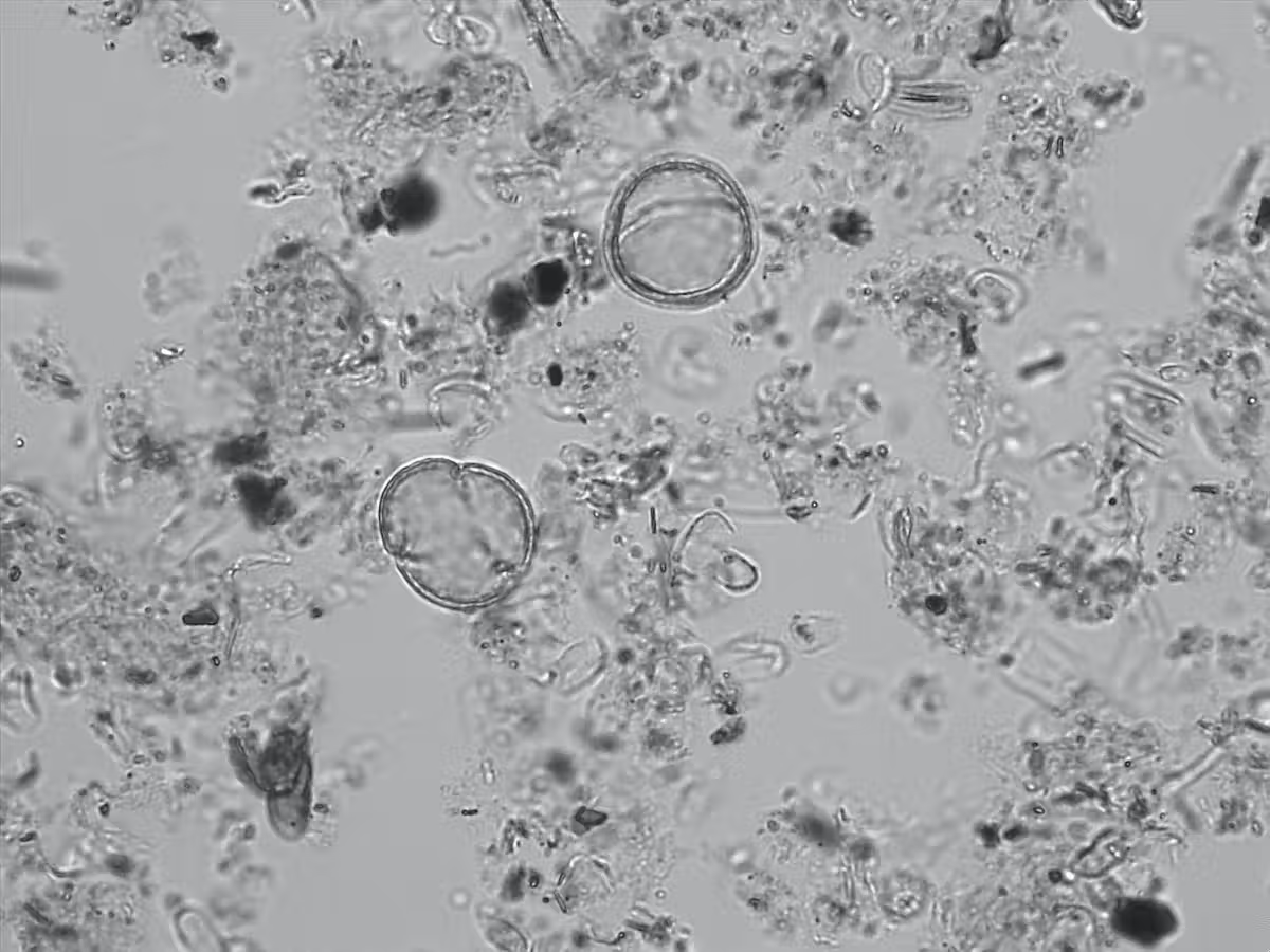 A pollen slide under the microscope at 40x magnification